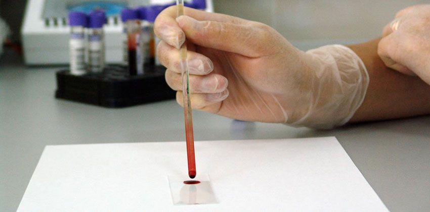 اختبار جديد يكشف عن 20 نوعا من السرطان