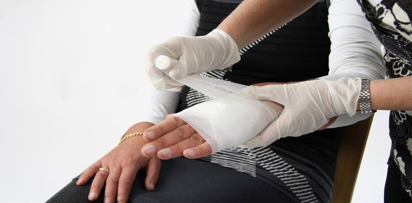 معالجة الحروق