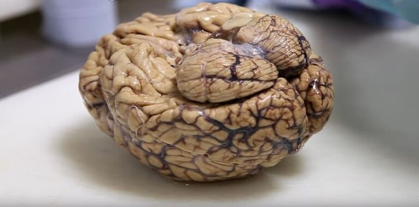 دماغ غامض