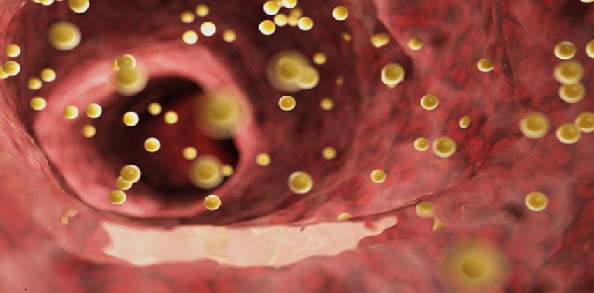 الكوليسترول