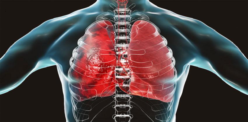 فيروس كورونا